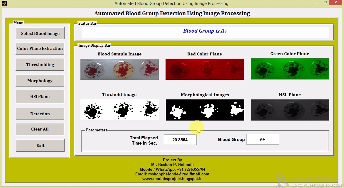 Blood Group Detection Using Image Processing Matlab Project with Source ...