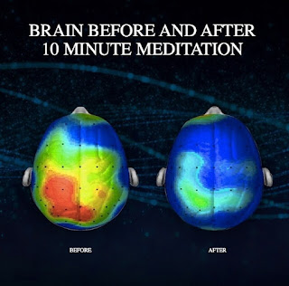 10 min meditation effect to the brain