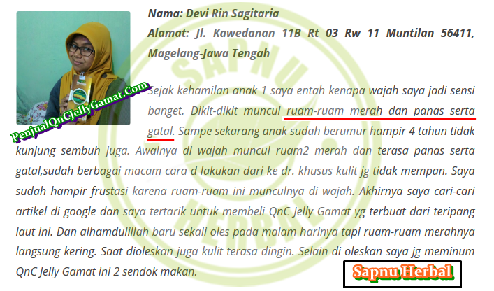 Obat Gatal Di Selangkangan Dan Kelamin Tradisional Terbukti Mujarab ~ TESTIMONI QNC JELLY GAMAT Obat Gatal Di Selangkangan Dan Kelamin Tradisional Terbukti Mujarab ~ TESTIMONI QNC JELLY GAMAT