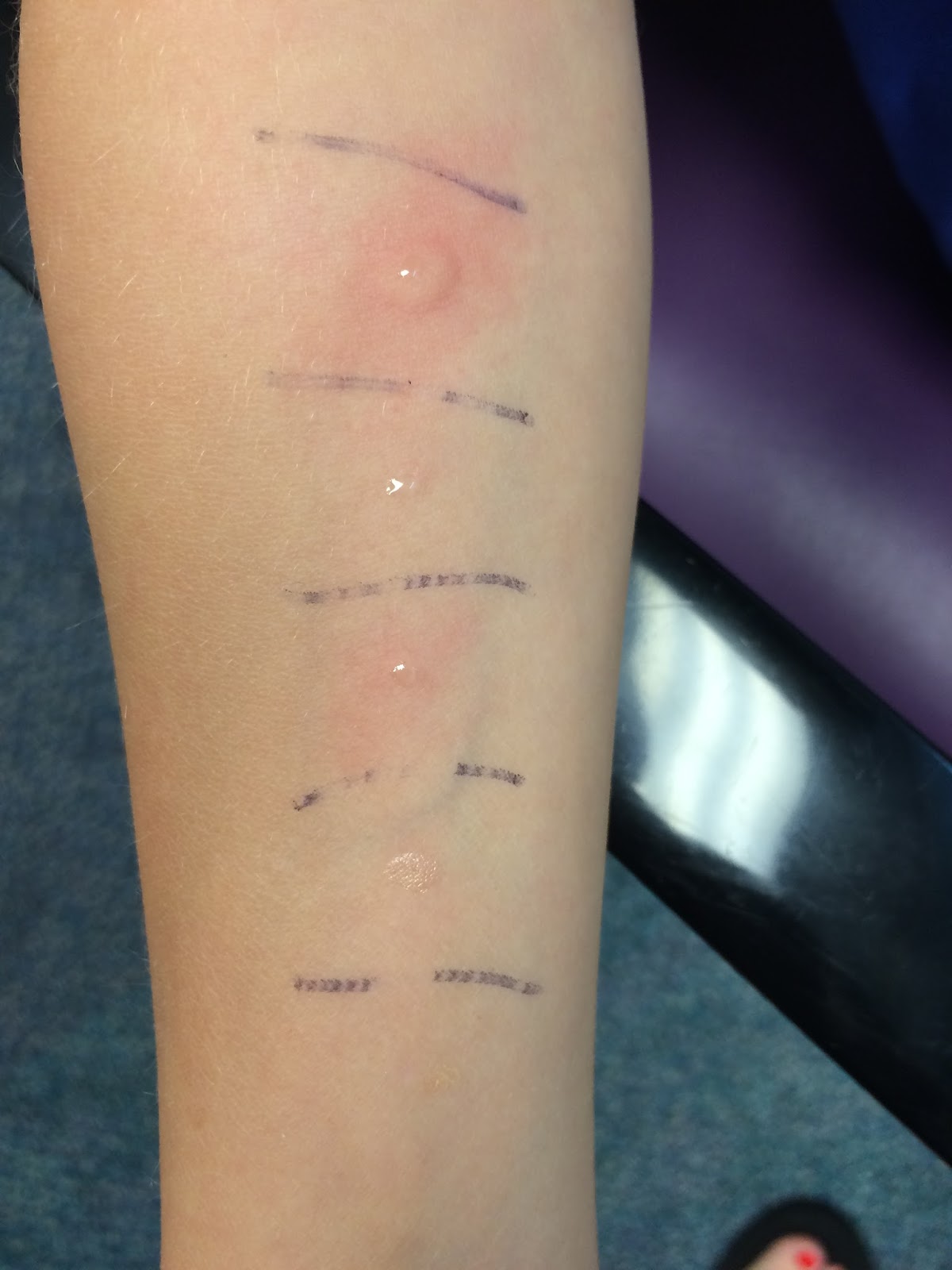 Let's Not Be Rash Soy Test