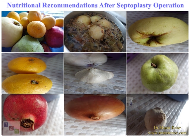 Nutrition after Septoplasty surgery - Nutrition recommendations after septoplasty operation - Precautions to be taken when eating after the operation of the septoplasty - Food that should not be eaten after the operation of the Septoplasty - Harmful dietary supplement products after septoplasty operation