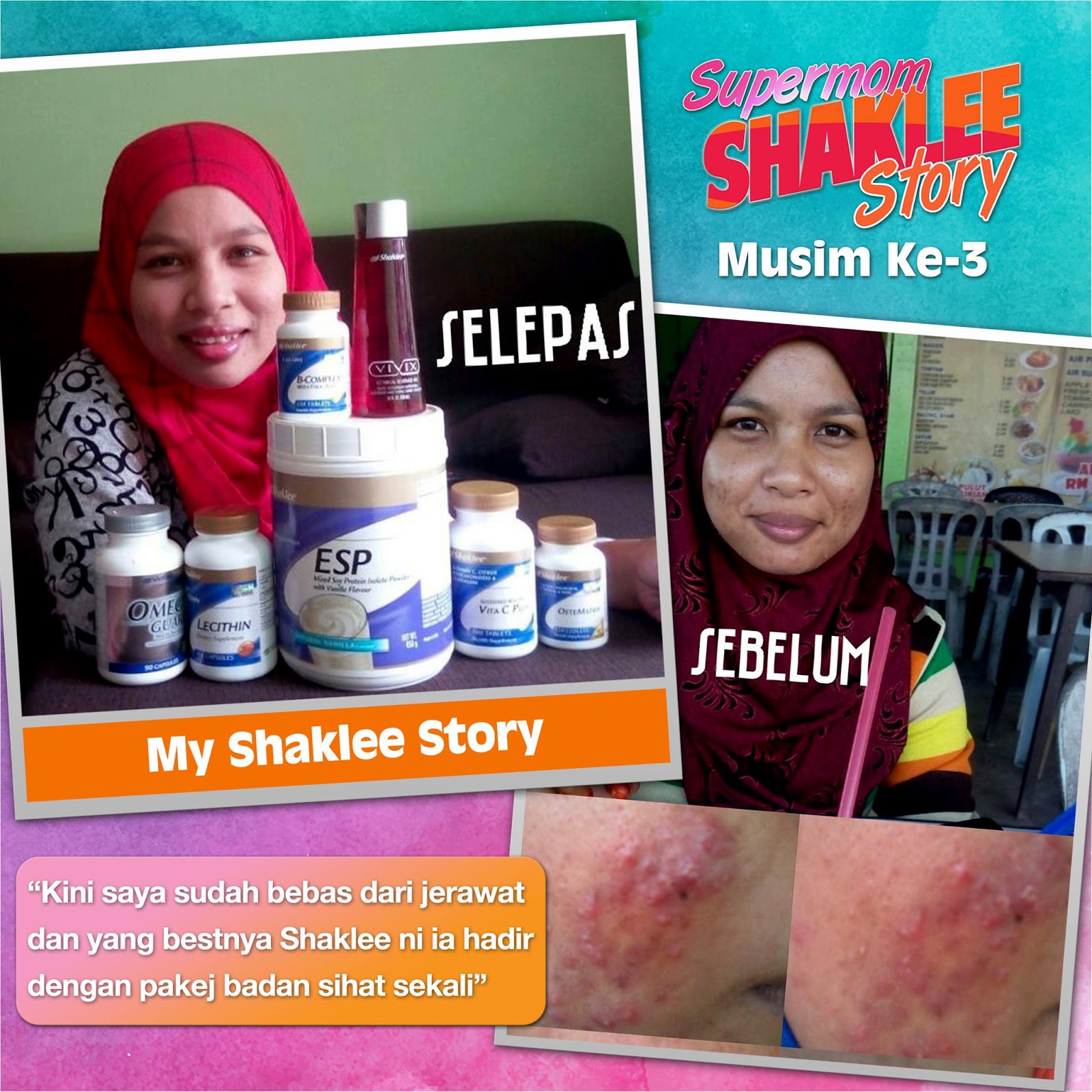 Shaklee set jerawat .: Mummynab