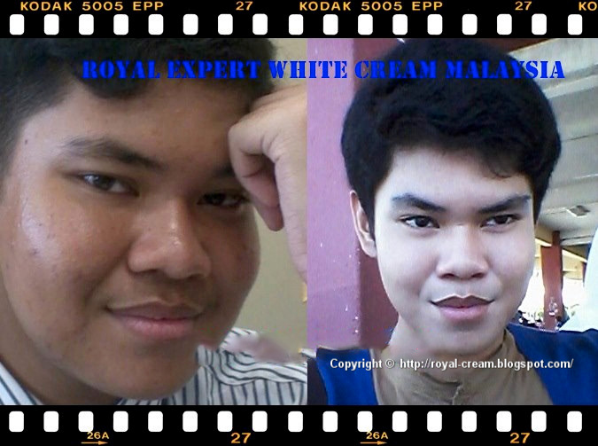 Royal Beauty Cream (Malaysia) Royal Expert White Cream Customer Feedback