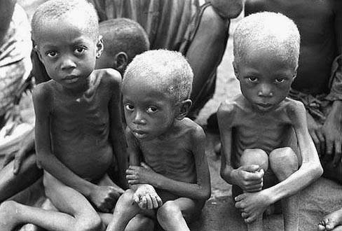 Starving children essay 05 image