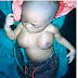 Baby Born With Full Grown Braest Trending Online (Photo)