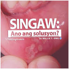 singaw in english - philippin news collections