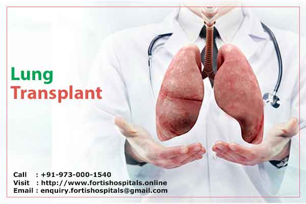 Lung Transplant: Facts, Cost & Procedure - Fortis Hospitals