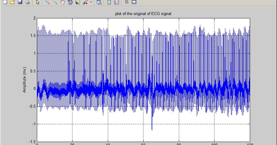 Biomedical Signal and Image Processing projects using Matlab and ...