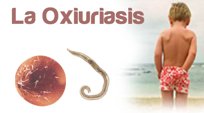 oxiuriasis enterobius vermicularis)