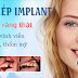 Thông tin bạn nên biết khi tiến hành làm cho răng giả bằng implant