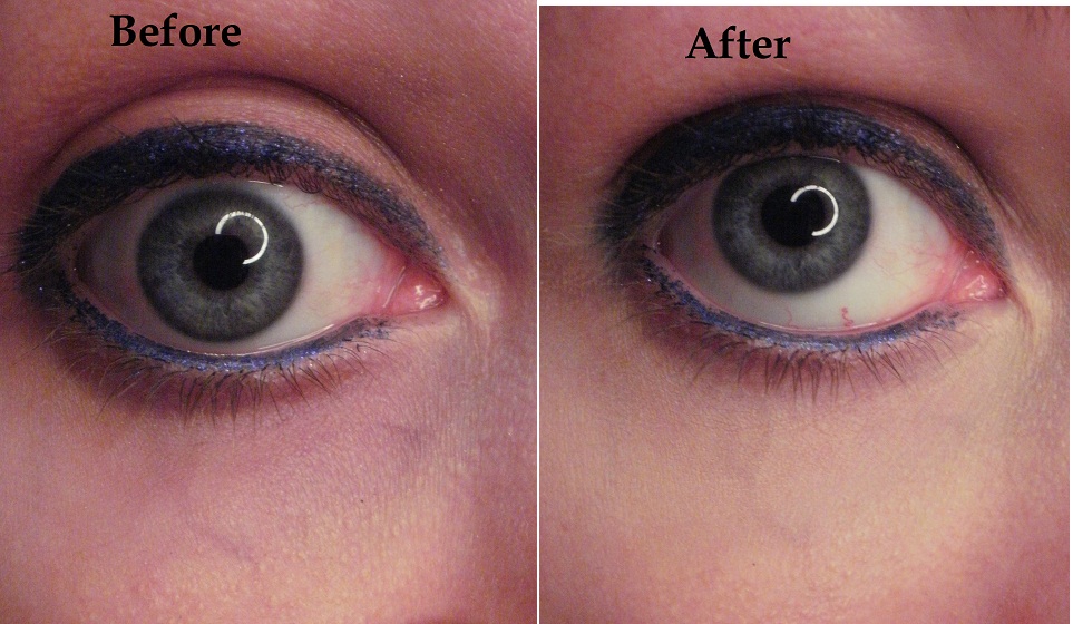 Dear Makeup Diary Physician's Formula Yellow Concealer Stick Review