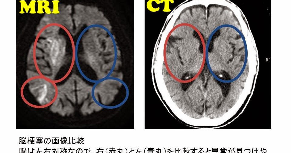 I'm a Radiographer!! Radiotechnologist!! 私は放射線技師！！ブログです
