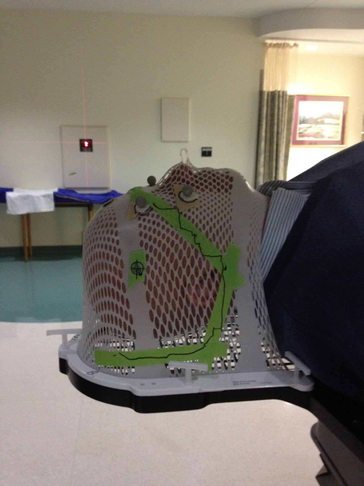 Jim Allen Lung Cancer Happens and we live on. Pic of new radiation mask