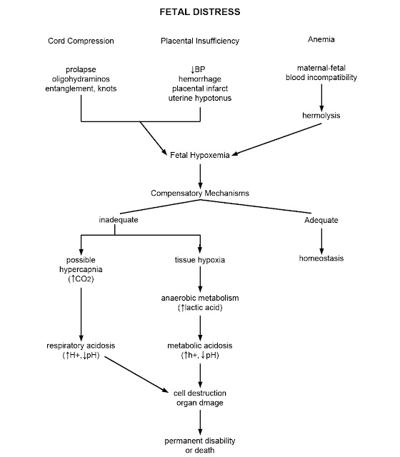 fetal-distress-nonreassuring-fetal-status