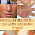 How To Get Rid of Pigmentation And Dark Spots Naturally