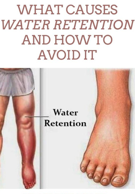 What Causes Water Retention And How To Avoid It Delicious Food Recipe