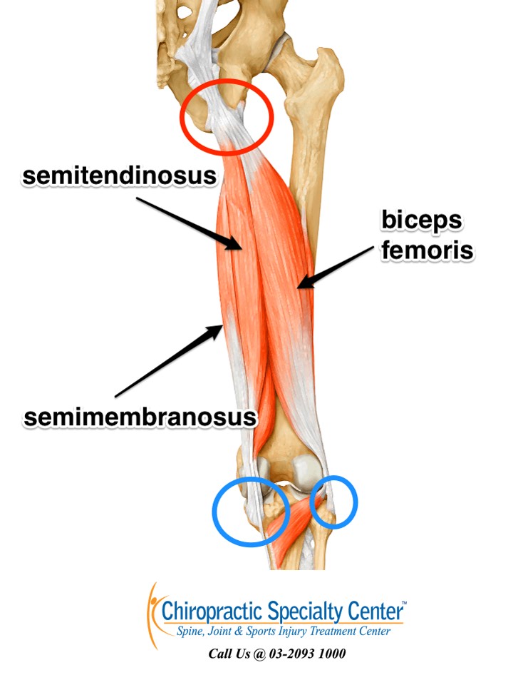 Tendinopathy of the Hamstring Origin