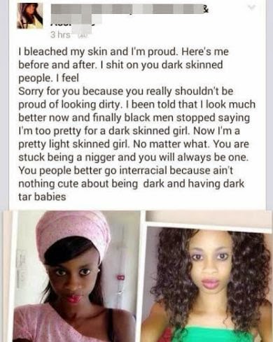 00 Before & after: Girl bleaches skin and abuses dark-skinned girls..lol