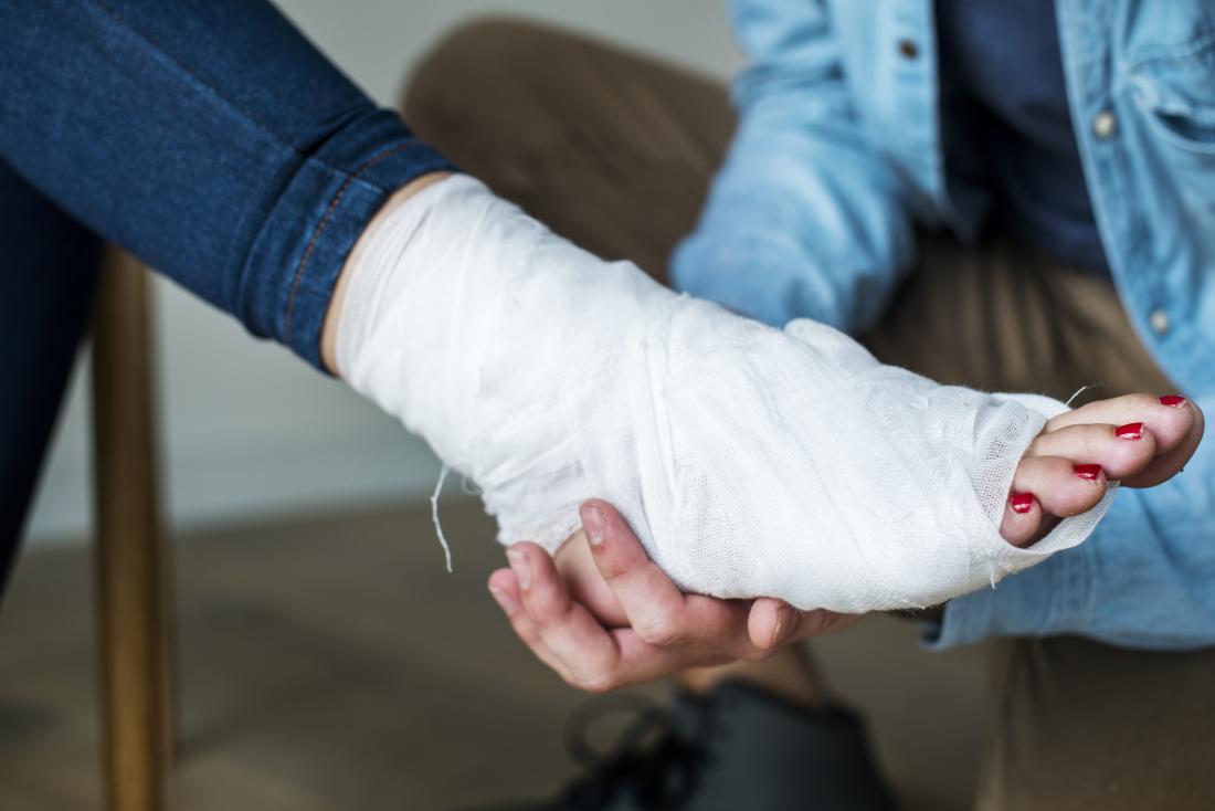 علاج تمزق اربطة القدم علاج تمزق اربطة القدم