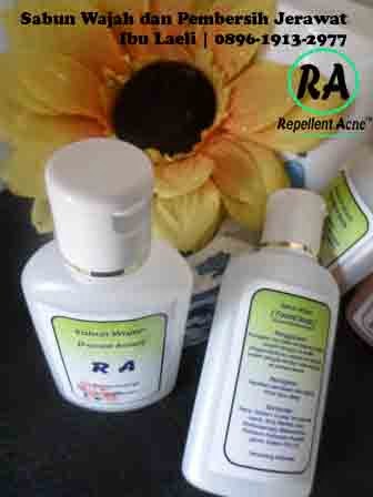 Obat Jerawat Alami, Ampuh dan Aman