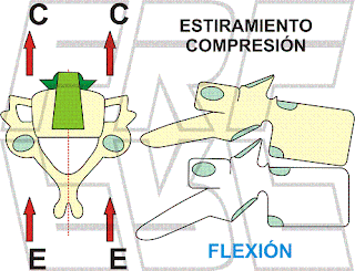 Compresión y estiramiento en la movilidad de un segmento vertebral.