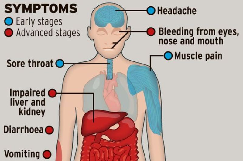 Symptoms of Ebola Virus