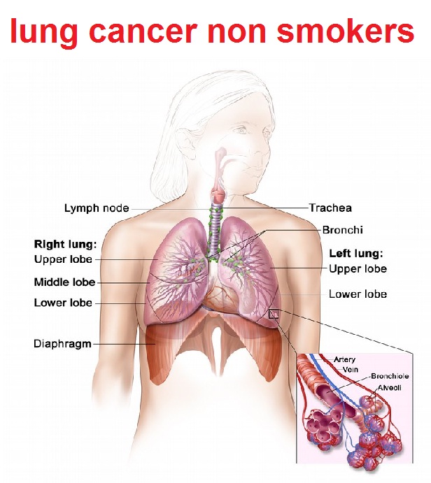 smokers-lungs
