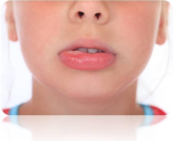 Swelling Below Lower Lip - Doctor insights on HealthTap