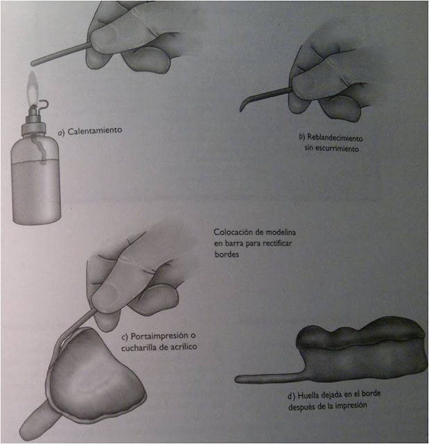 MATERIALES DENTALES FES