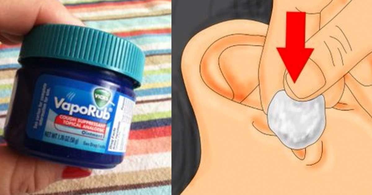 If You Put A Cotton Ball With VapoRub In Your Ear