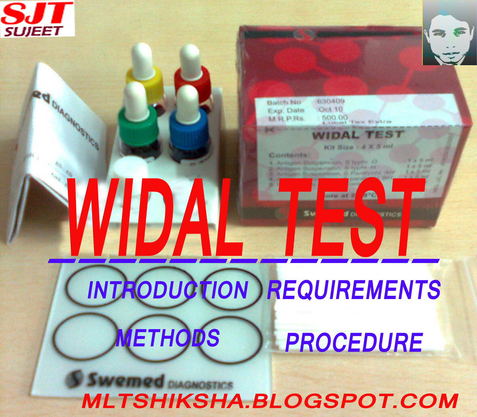 Widal Test