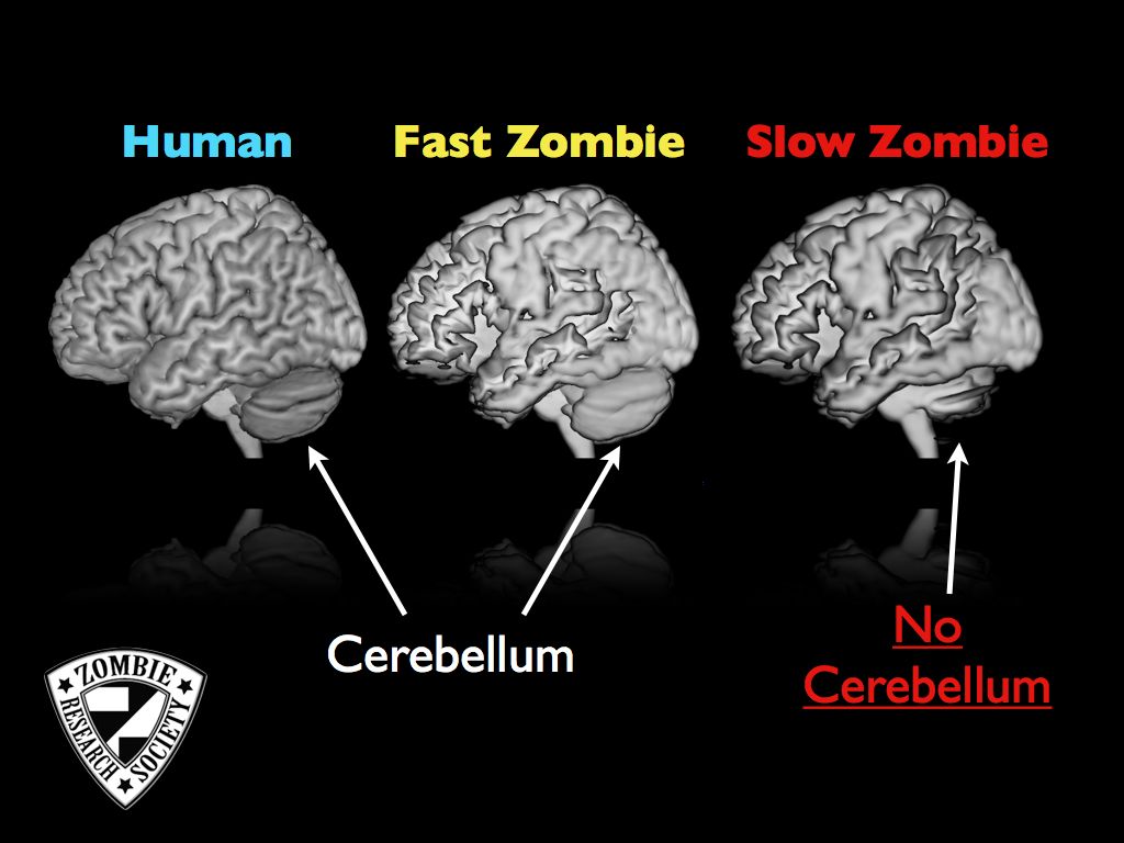 Zombie neuroscience: Inside the brains of the walking dead