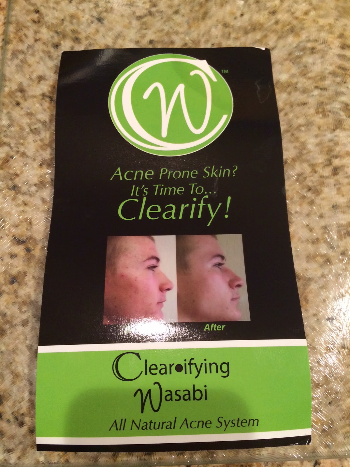 Beauty Babble Review Derma MD Skincare & Wasabi AntiAcne Kit (Part 1)