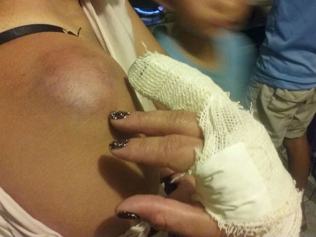 Com cassetete, PM quebra dedo de mulher que filmava derrubada no DF; veja vídeo