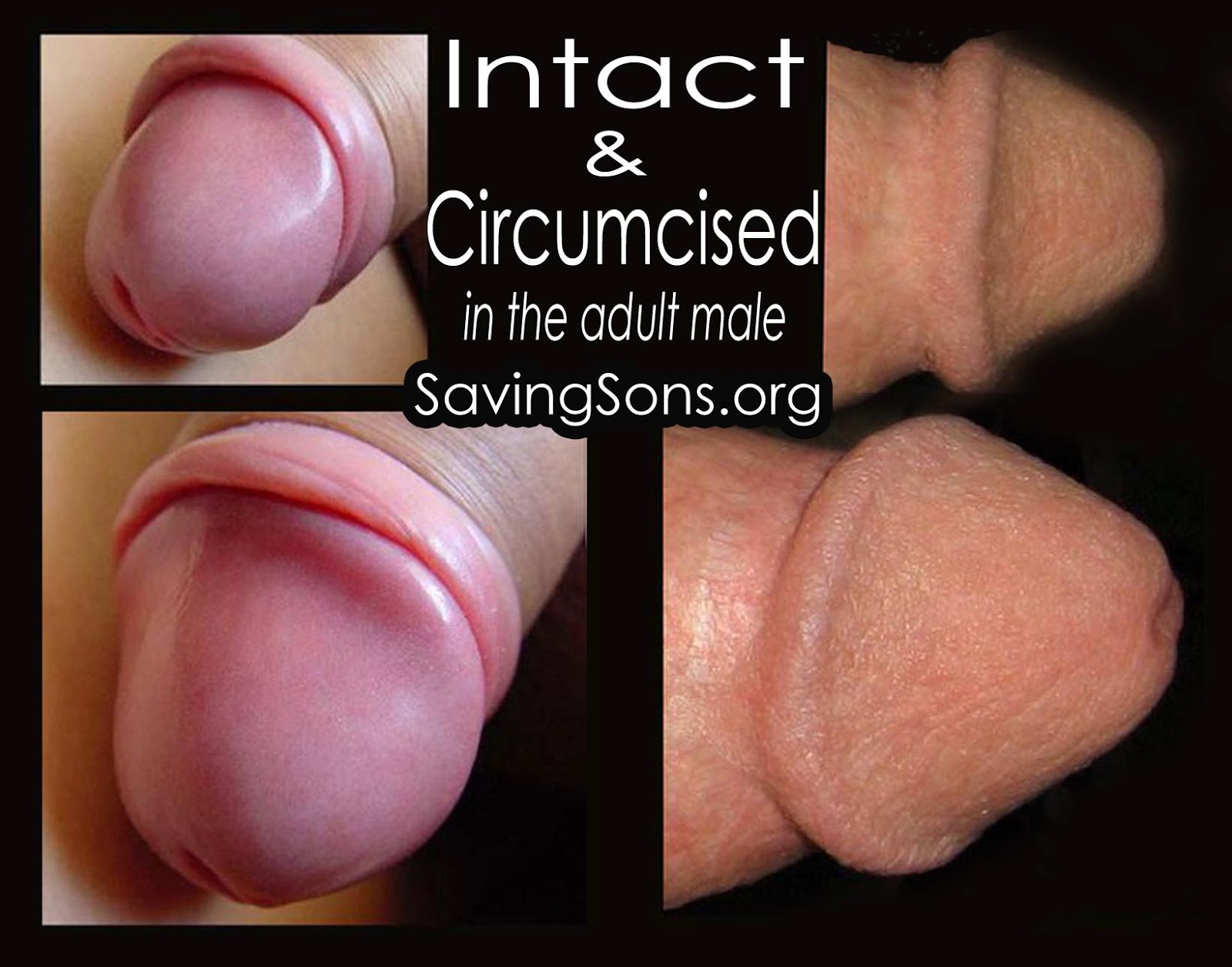 Intact Adult Penis 99