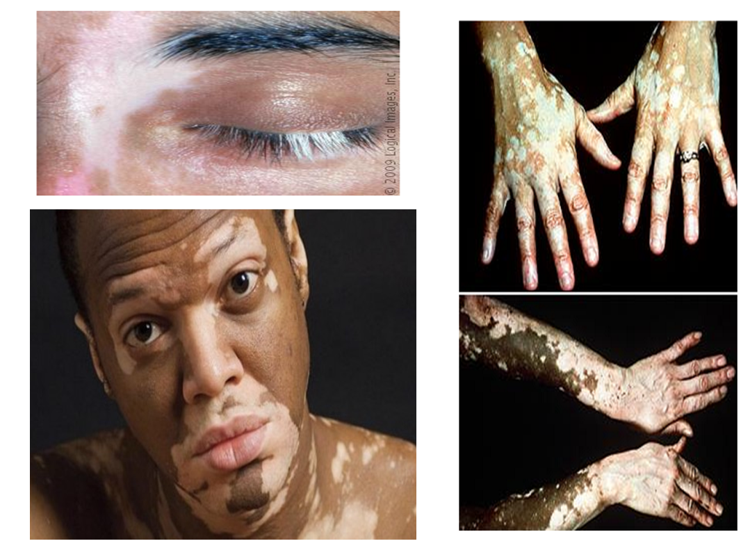 Asbestos Asbestos On Skin