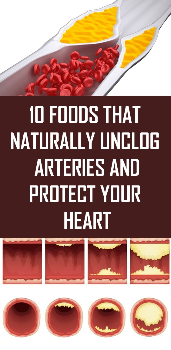 Here Are 10 Foods That Naturally Unclog Arteries & Protect Your Heart!!!