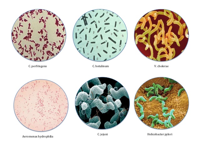 Кластридии. Clostridium botulinum микроскоп. Клостридии перфрингенс микроскопия. Клостридия перфрингенс микробиология. Клостридиум перфрингенс возбудитель.