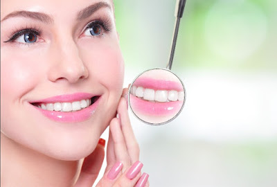 invisalign in bangalore