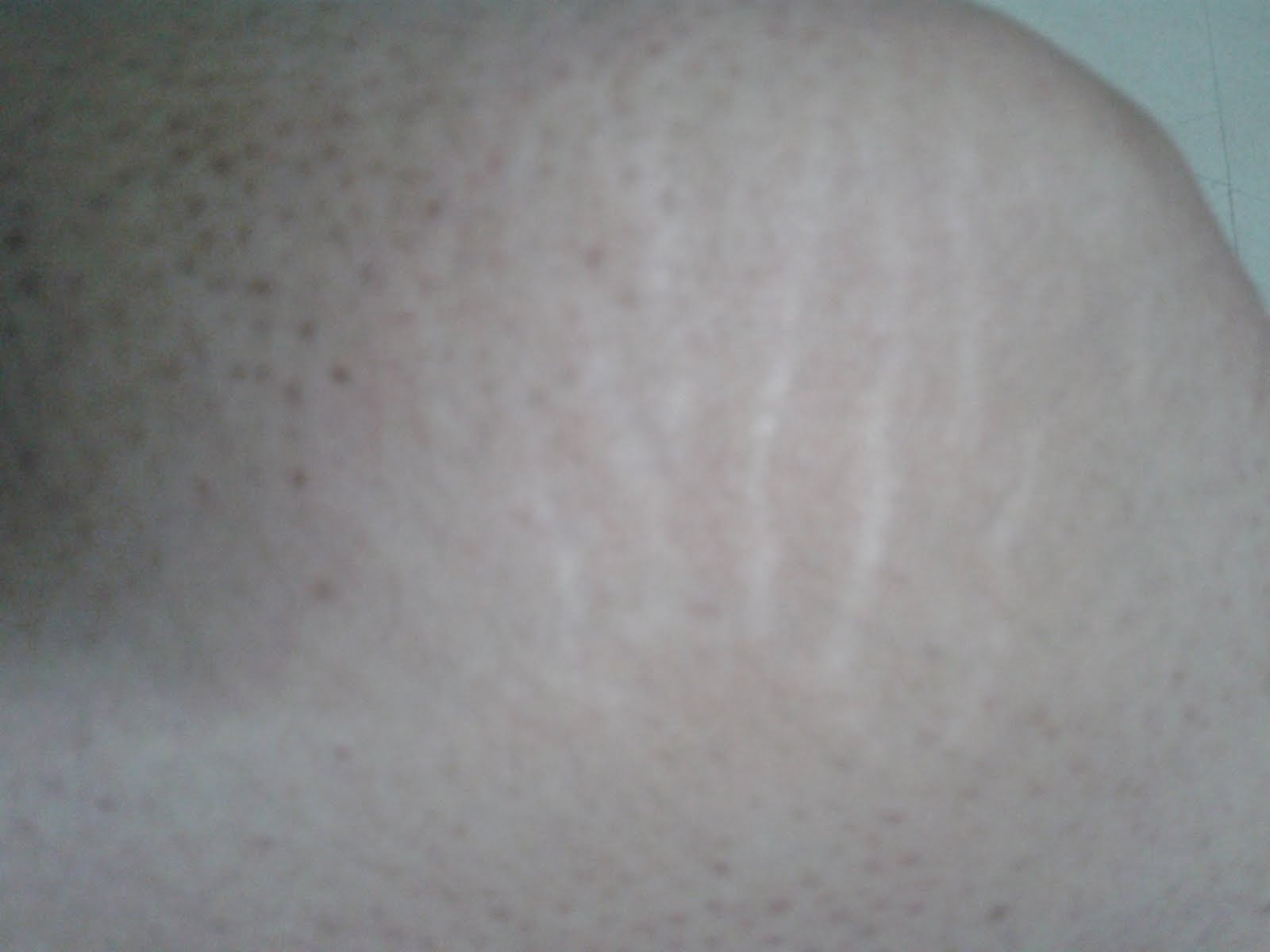 dermarollers bangalore Derma Roller Instructions How to Use a