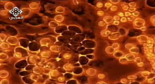 ��������� blood-cancer.JPG