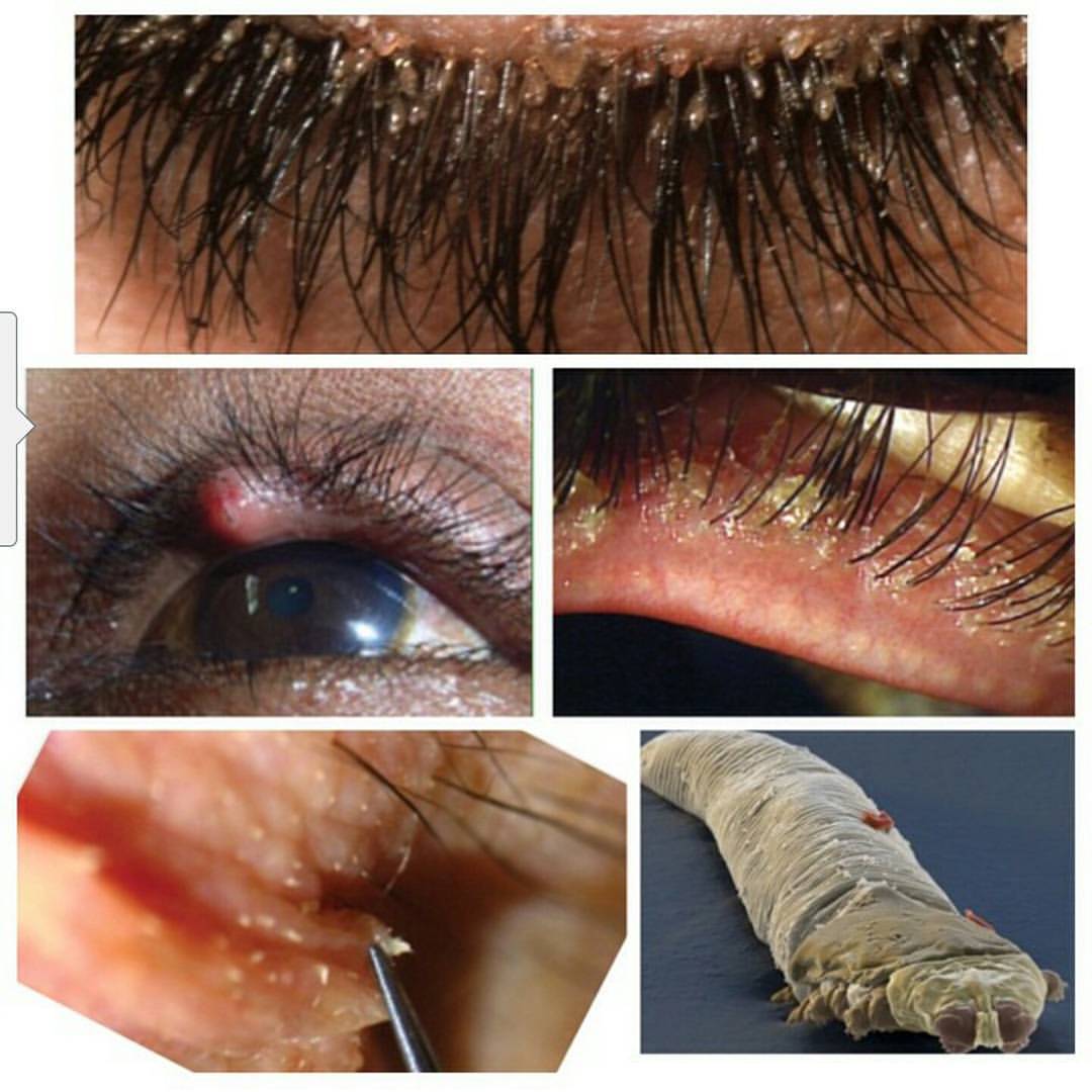 LADIES The side effects of wearing fake eyelashes(Photos)