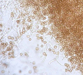 round spores of Chaenotheca brunneola