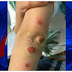 WARNING: POPULAR “CHILD-FRIENDLY” HOBBY IS SPREADING SERIOUS INFECTION TO KIDS