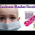Obat Kanker Darah Leukimia Pada Anak