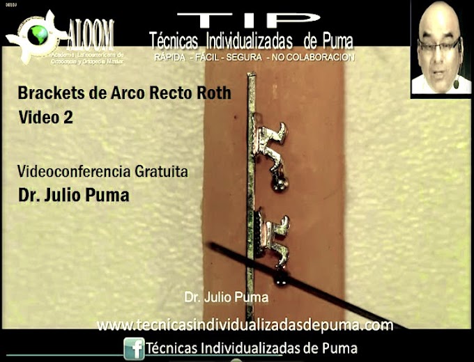 BRACKETS: Arco Recto Roth y Edgewise - Dr. Julio Puma (Video 2)
