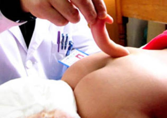 5 Bayi Aneh Bin Ajaib Yang Lahir di Dunia 5 Bayi Aneh Bin Ajaib Yang Lahir di Dunia
