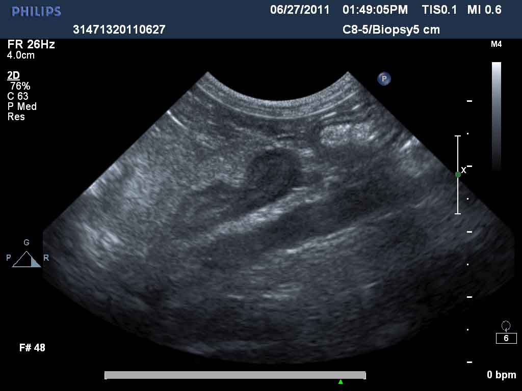 Animal Ultrasound Clinic Enlarged Adrenal in a Pomeranian