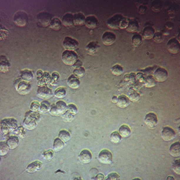 The Dryad�s Diatribe SeeMyScience Cancer Cachexia Cell