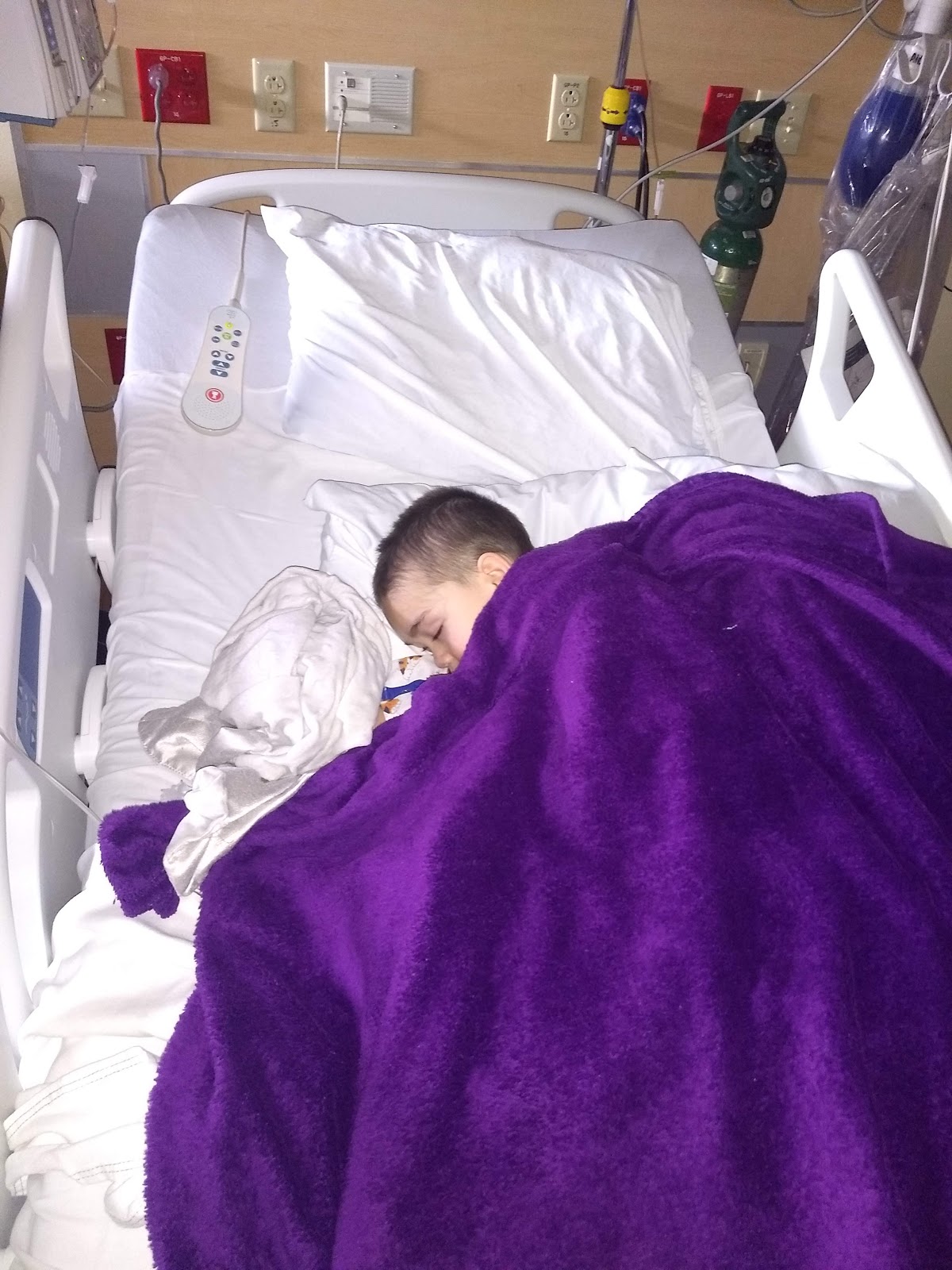 Gm1 Gangliosidosis Type 2 Our Experience Evan's GTube Surgery